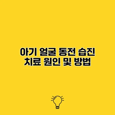 아기 얼굴 동전 습진 치료 원인 및 방법